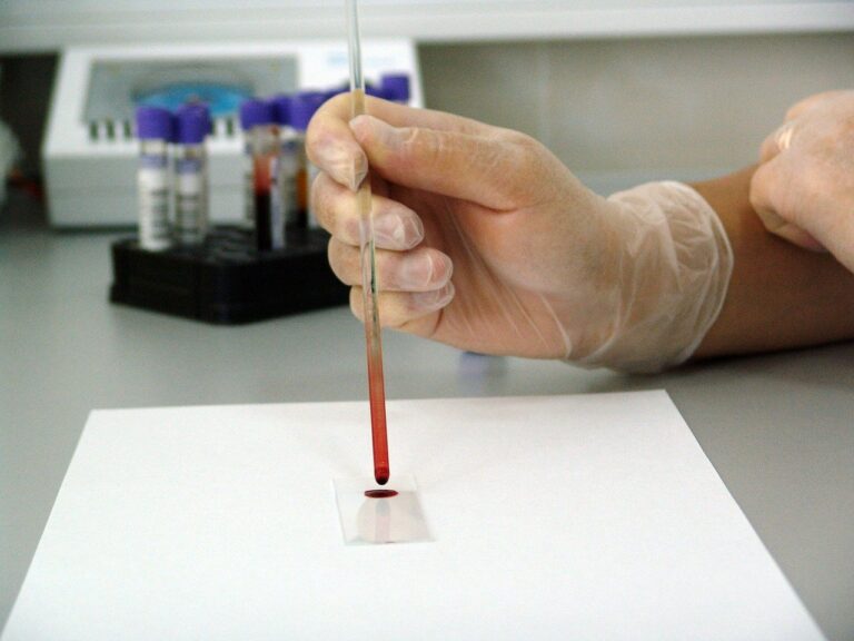 Blood Test
